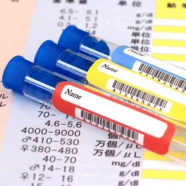 生活習慣病の指導