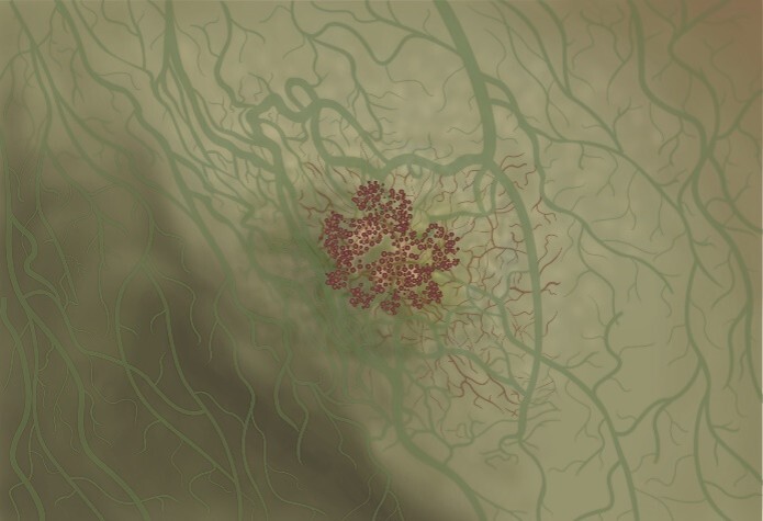 癌の早期発見　深津内科医院