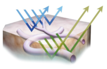 癌の早期発見　深津内科医院